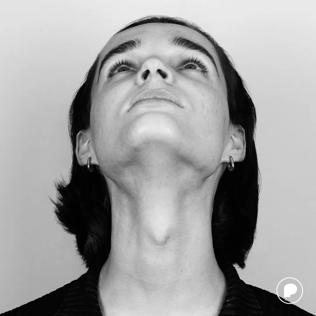 Frontal image of Negin looking up before surgery.
